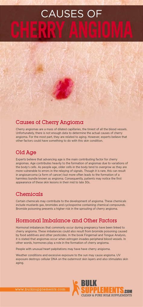 A cherry angioma is a common skin growth that can develop on most areas of the body. . Cherry angioma or cancer